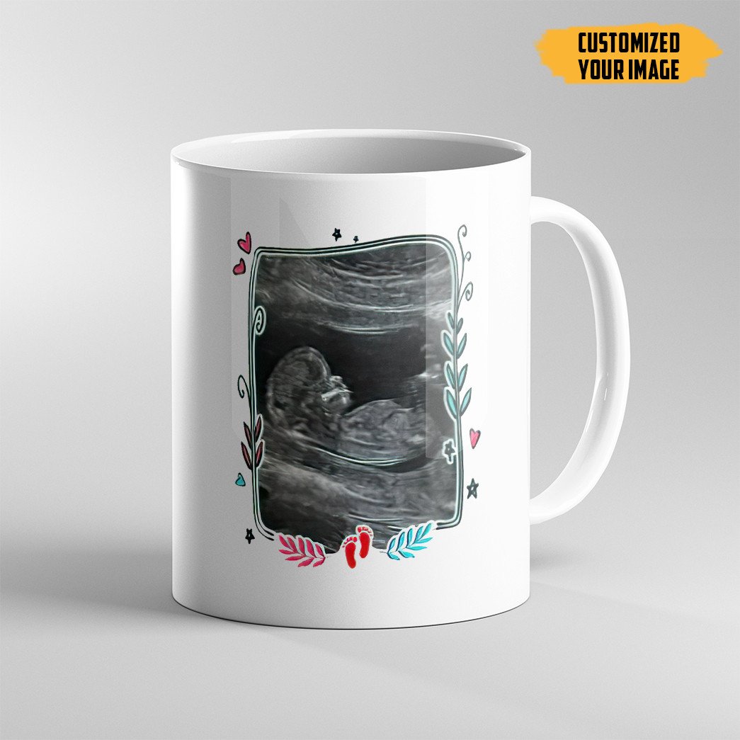 Gearhumans 3D Mothers Day Gift For Expecting Mom Mommy Are You Ready Custom Photo Mug